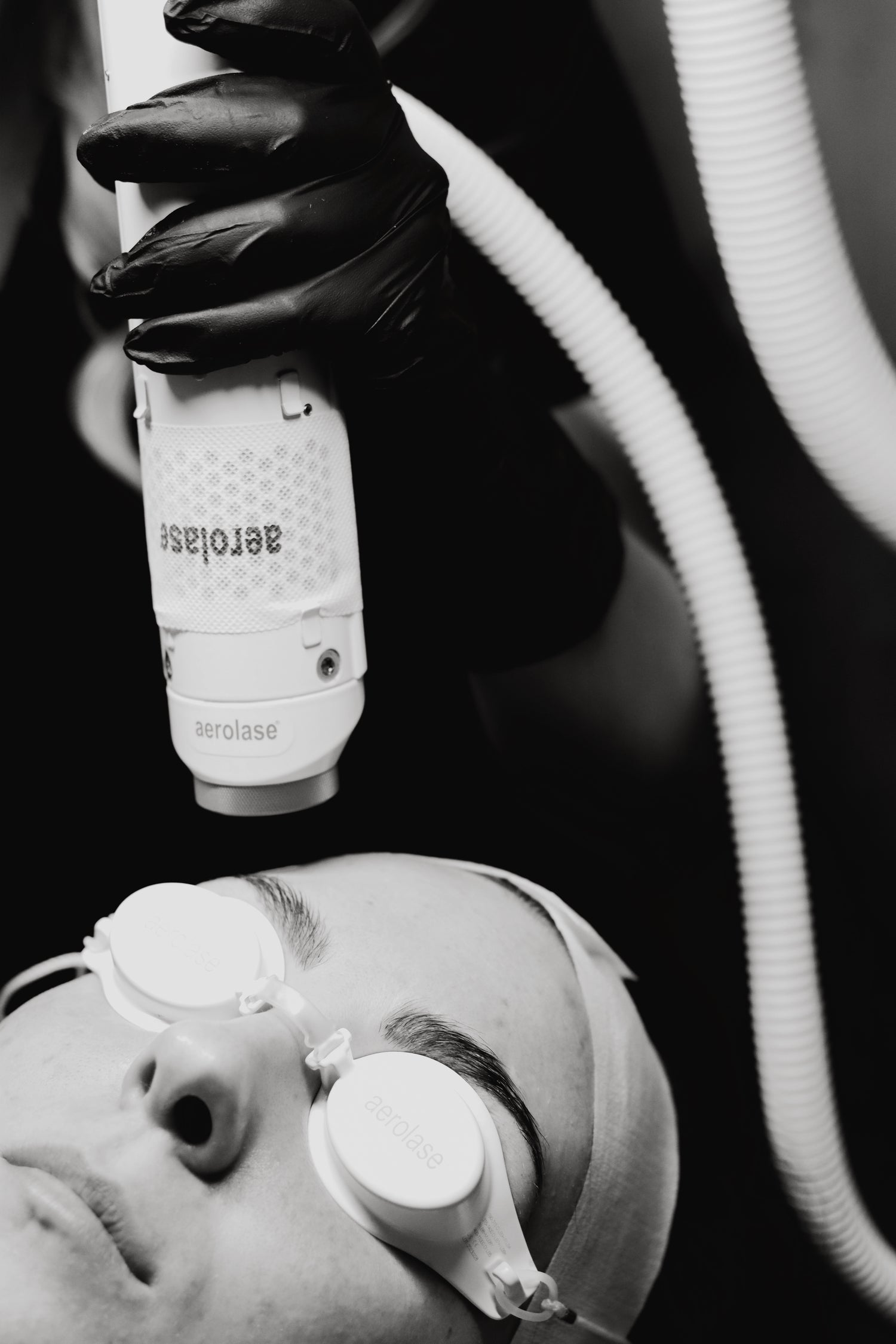 Person receiving a laser treatment on their face with a machine labeled 'aerolase' applied to their skin.