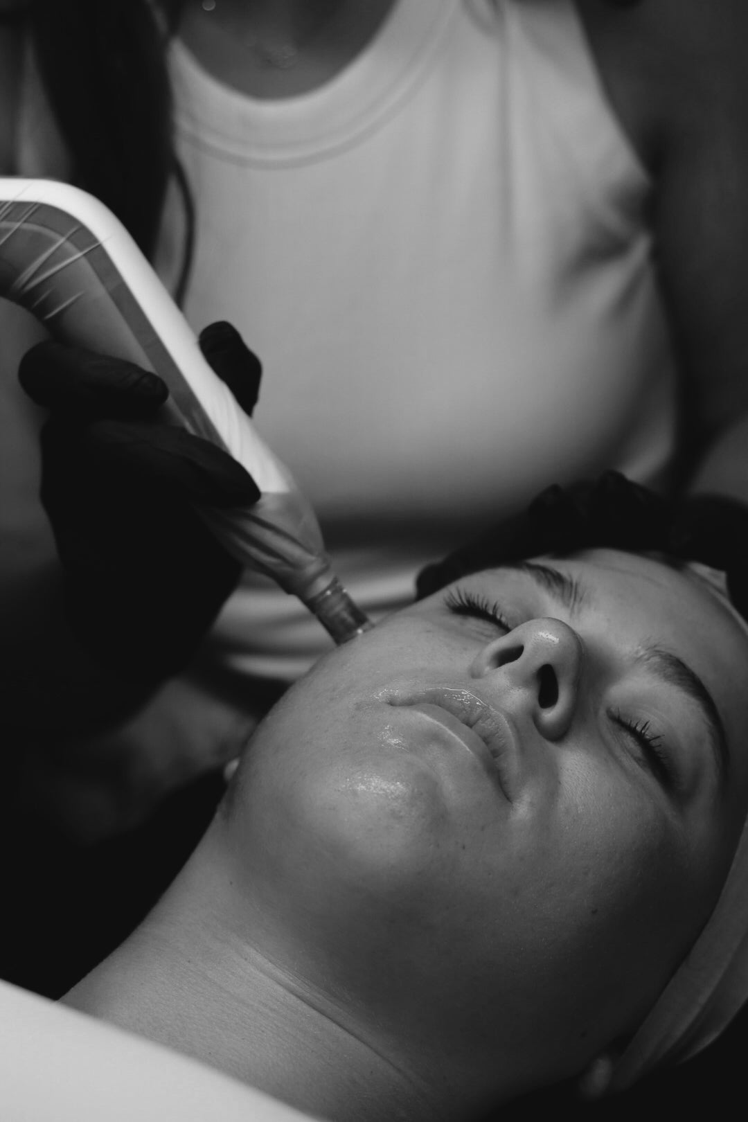 Collagen Starter Treatment