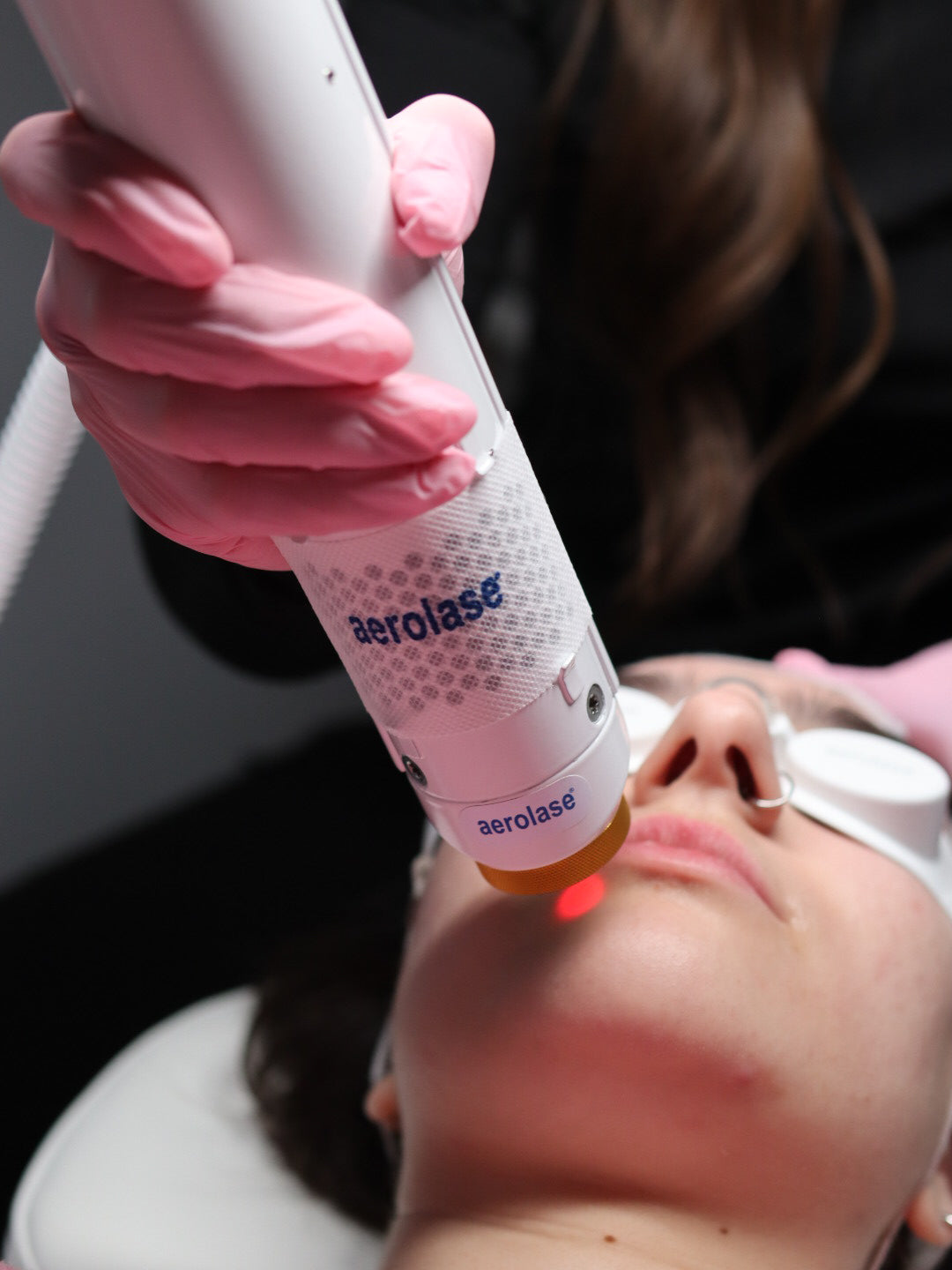 Aerolase Face Rejuvenation | Series of 6 image 0