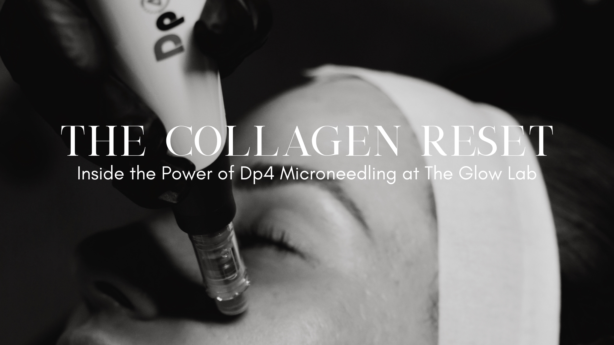 Maple Ridge Lab Microneedling Maple Ridge | Dp4 Collagen Rejuvenation at The Glow Lab