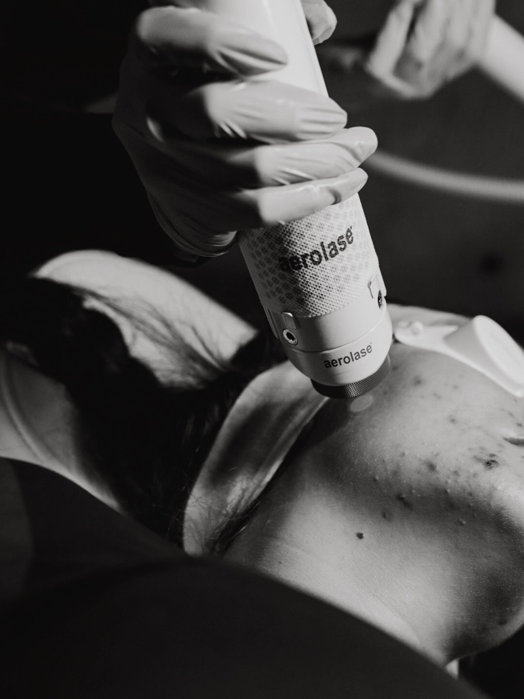 CLEAR SKIN (ACNE + CONGESTION)