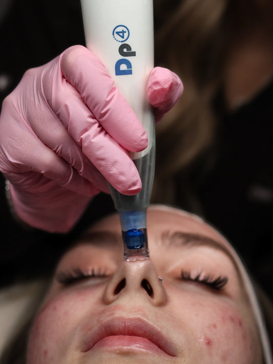 DP4 Microneedling  | Series of 3 image 0
