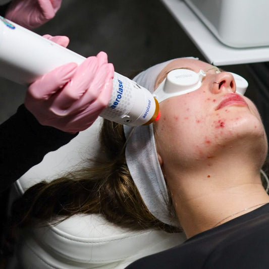 The Clear Skin Series | 6 Week Program * image 0