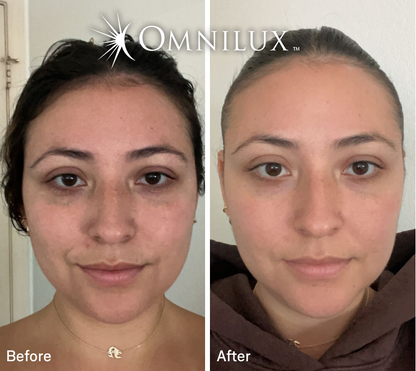 Omnilux Contour™ Face LED Mask — Preorder