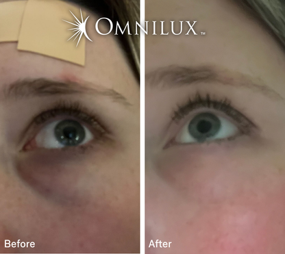 Omnilux Eye Brightener — Preorder