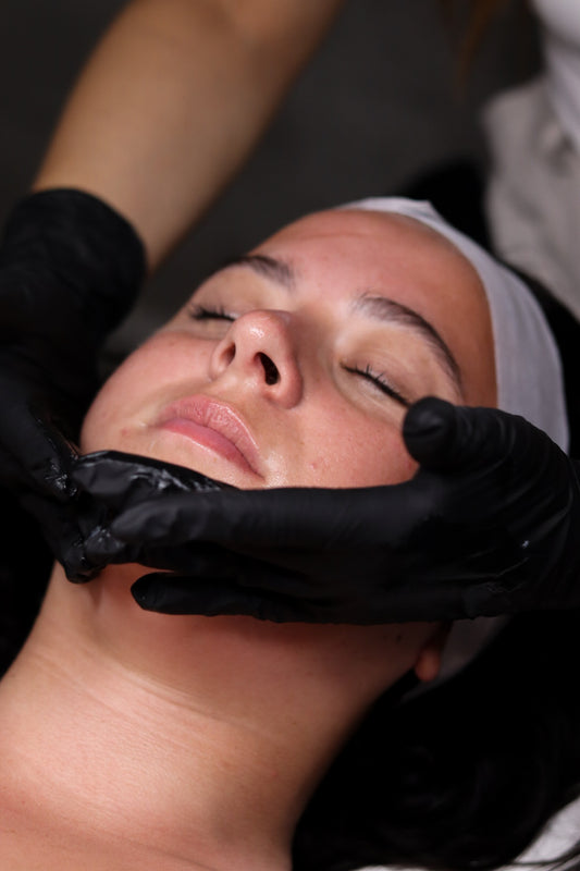 Customized Chemical Peel