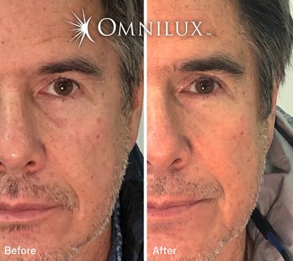 Omnilux Men™ Face LED Mask — Preorder