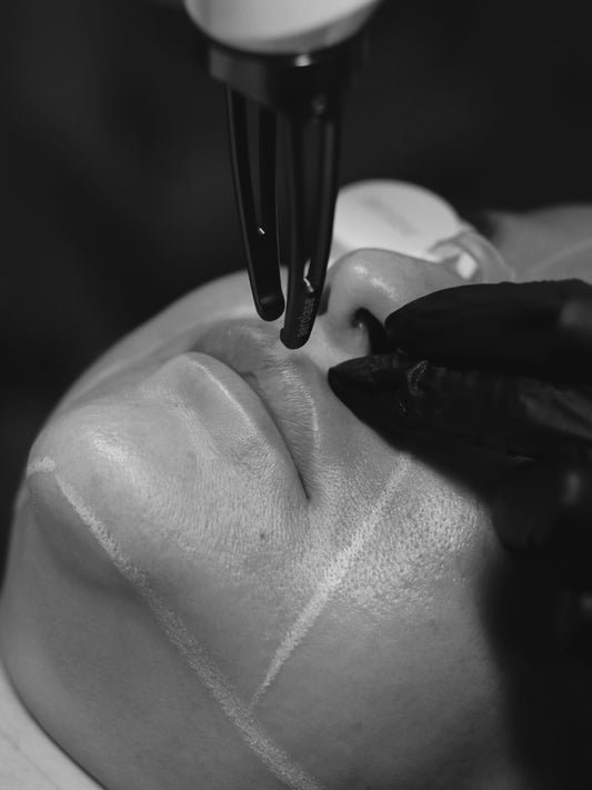 Aerolase Lip Plumping Treatments | Series of 6