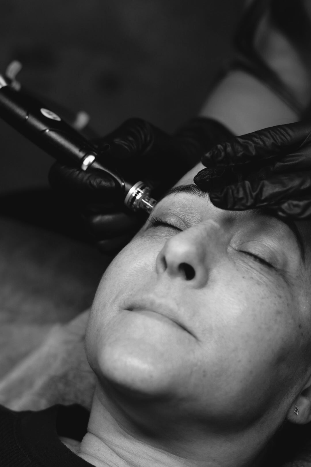 Maple Ridge Lab Microneedling Maple Ridge | Dp4 Collagen Rejuvenation at The Glow Lab