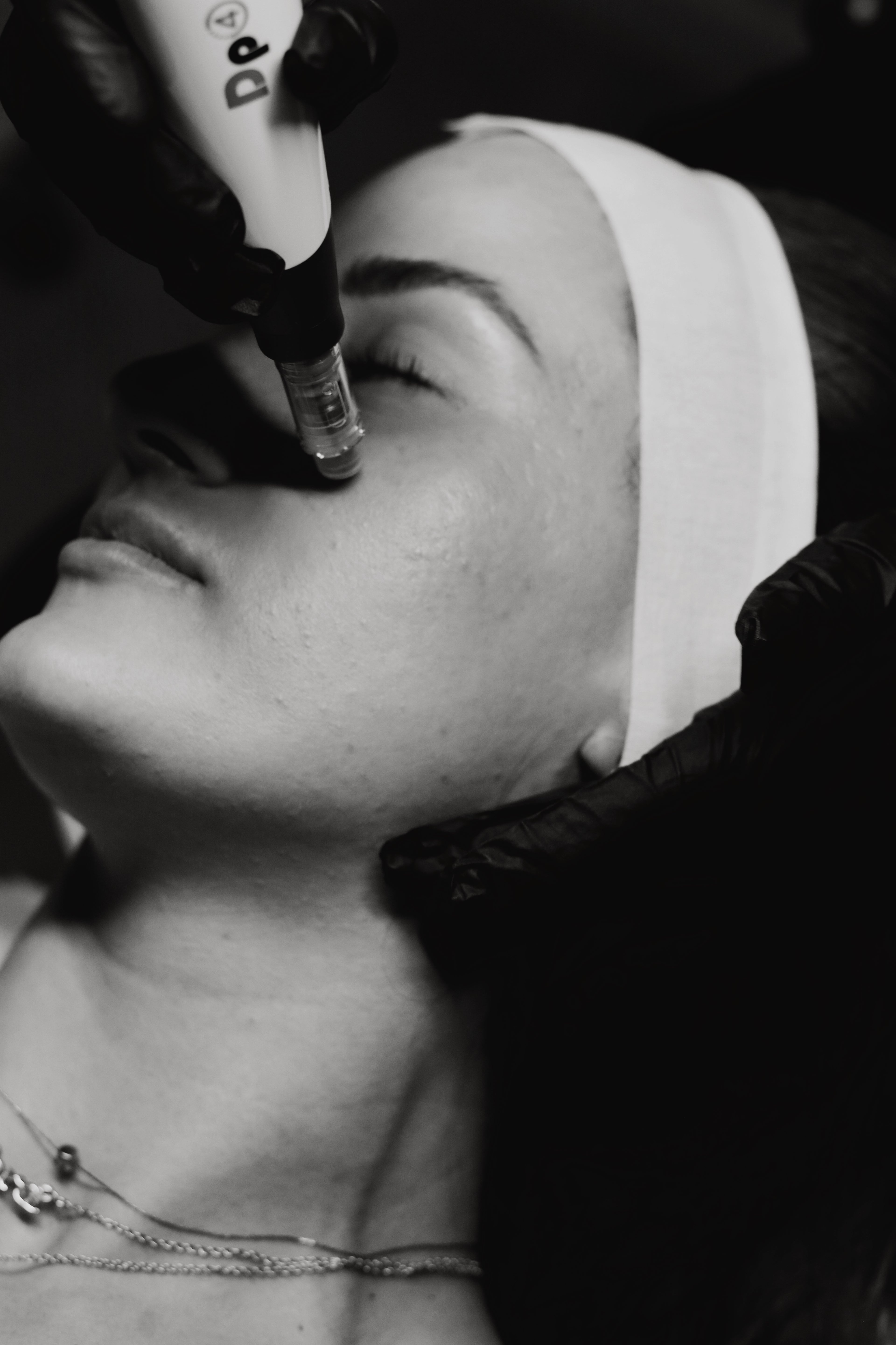 Black and white photo of a person receiving a facial treatment with a device.