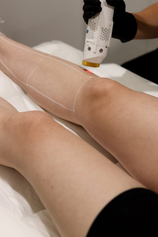 Aerolase Neo Laser Hair Removal Treatments | Series of 6 image 0